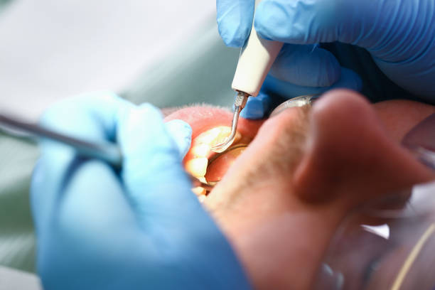 Best Emergency Tooth Extraction  in Maxwell, CA